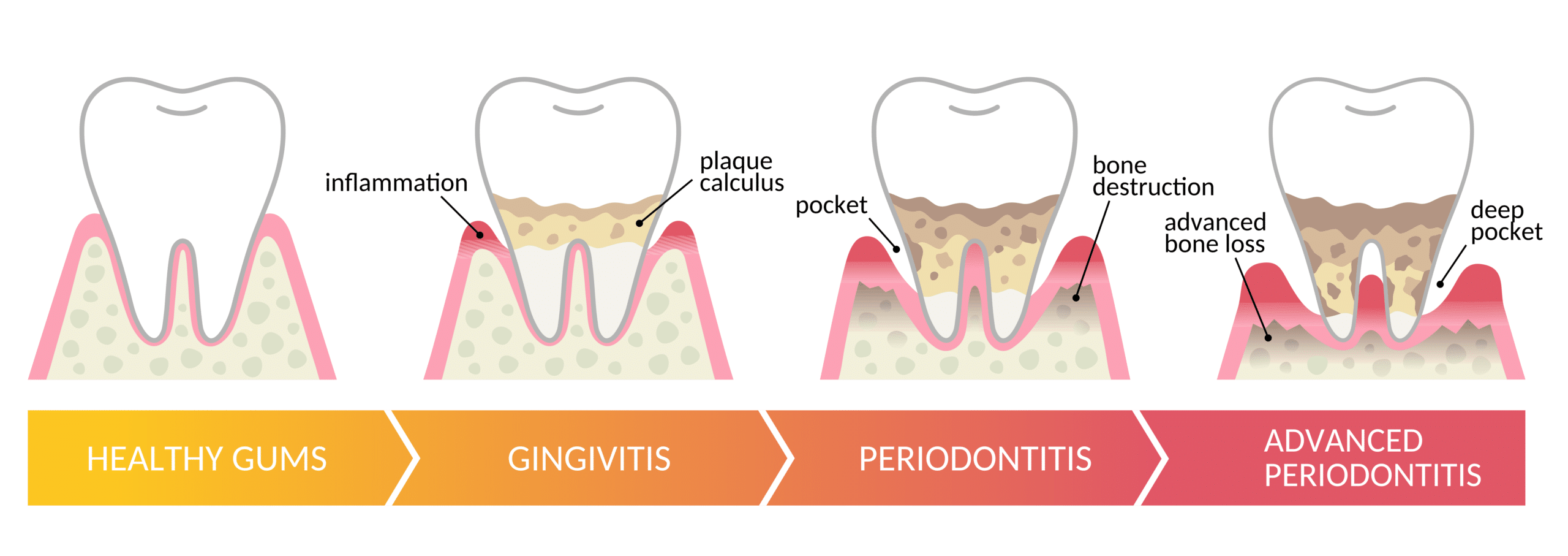 Periodontal Therapy